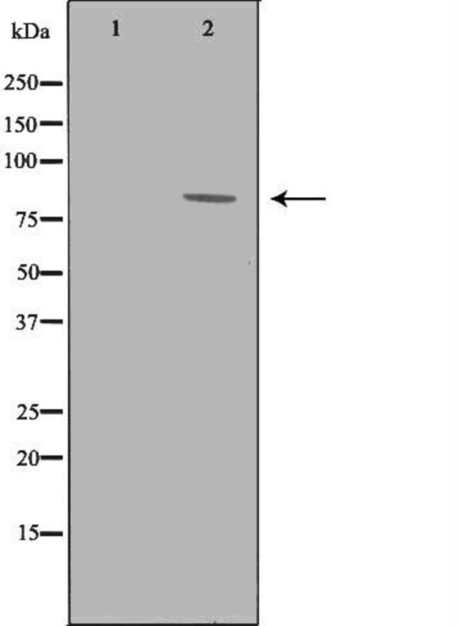 100 ULGRK3 ANTIBODY 100