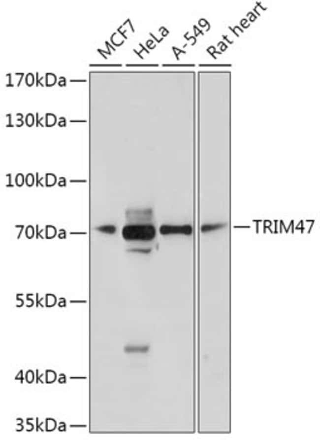 100 UL TRIM47 ANTIBODY