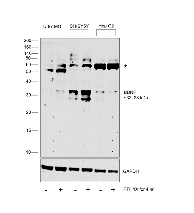 Anti-BDNF 0.1 mg