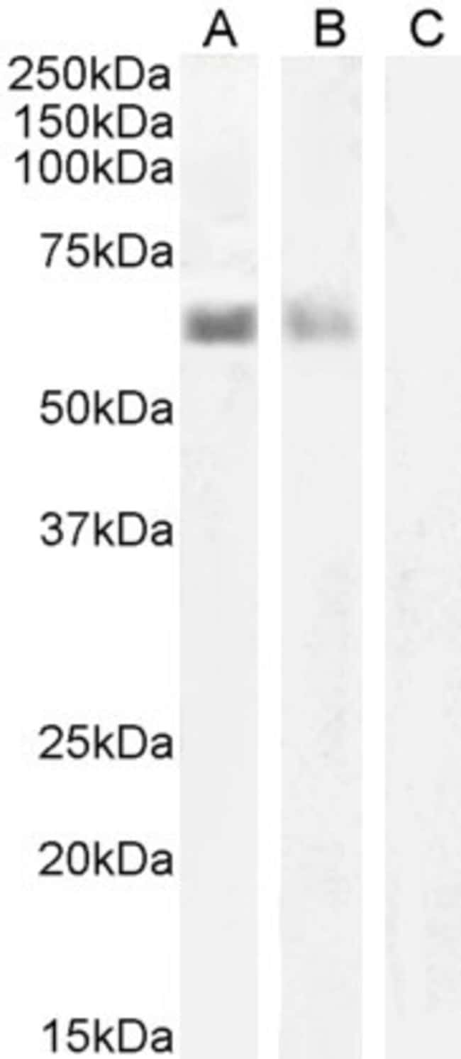 AIRE Polyclonal Antibody 100  g  G