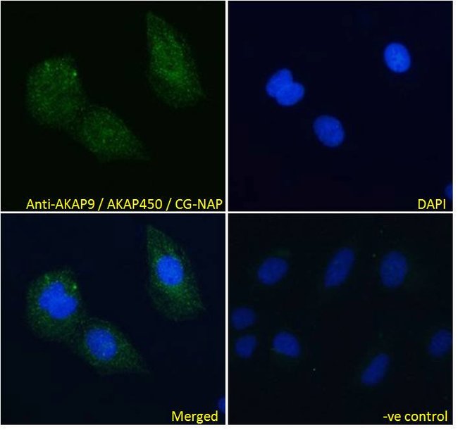 AKAP9/AKAP450/CG-NAP Polyclonal Antibody