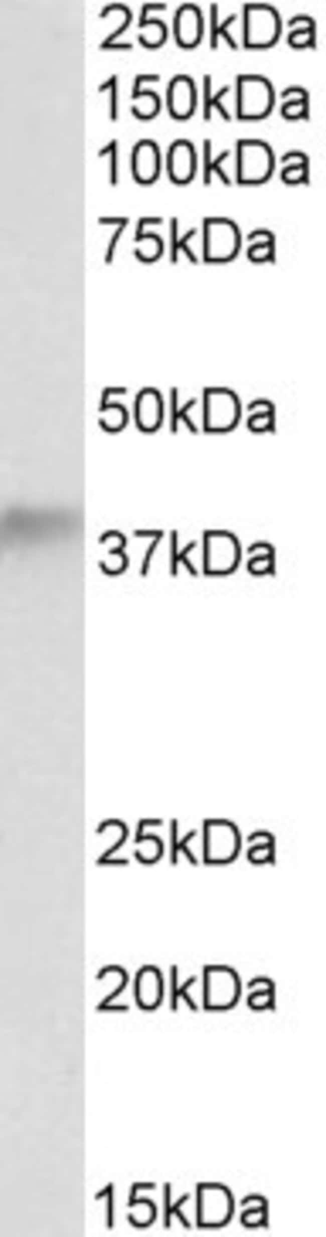 ADH5 Polyclonal Antibody 100  g  G