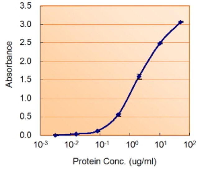 ALDH2 Polyclonal Antibody 100  g  G