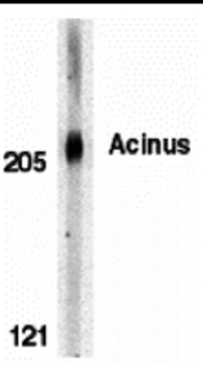 Acinus Polyclonal Antibody, 100  g