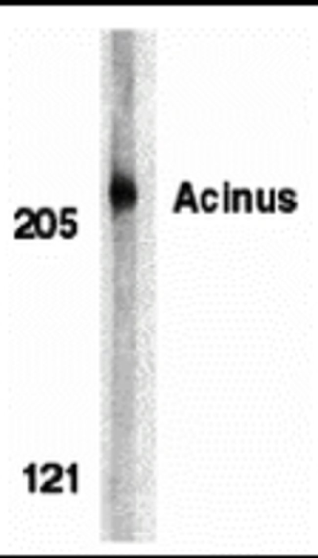 Acinus Polyclonal Antibody, 100  g