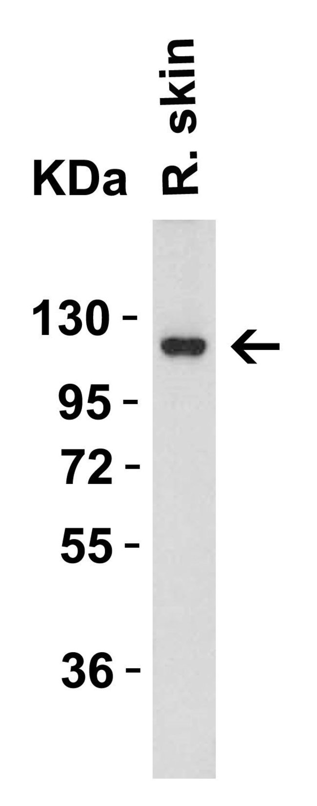 ACE2 Polyclonal Antibody, 100  g