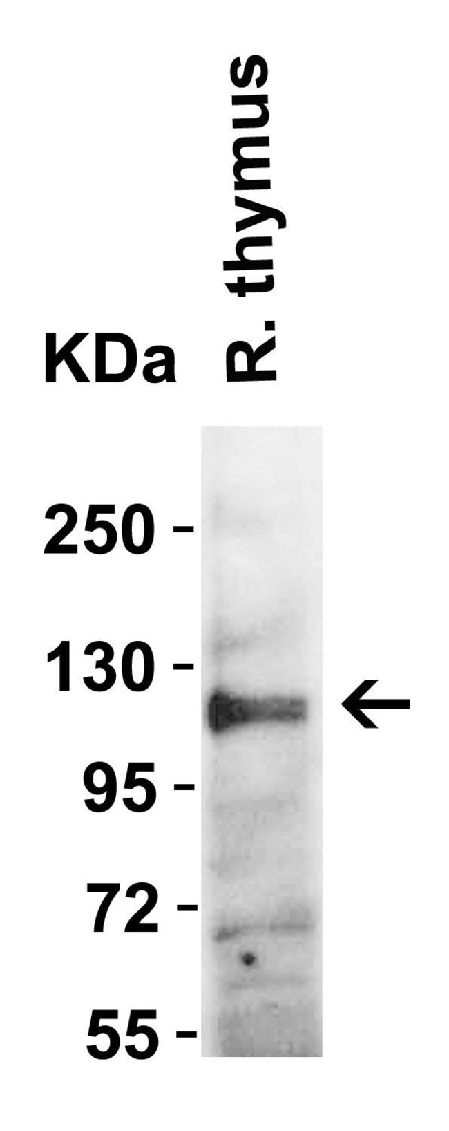 ACE2 Polyclonal Antibody, 100  g