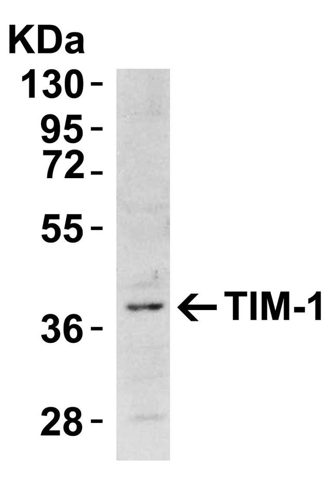 100UG TIM-1 Polyclonal Antibody, 100  g