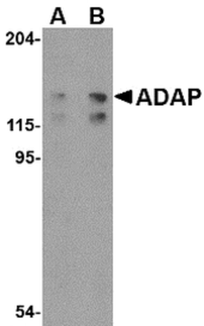 ADAP Polyclonal Antibody, 100  g