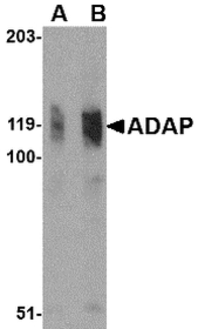 ADAP Polyclonal Antibody, 100  g