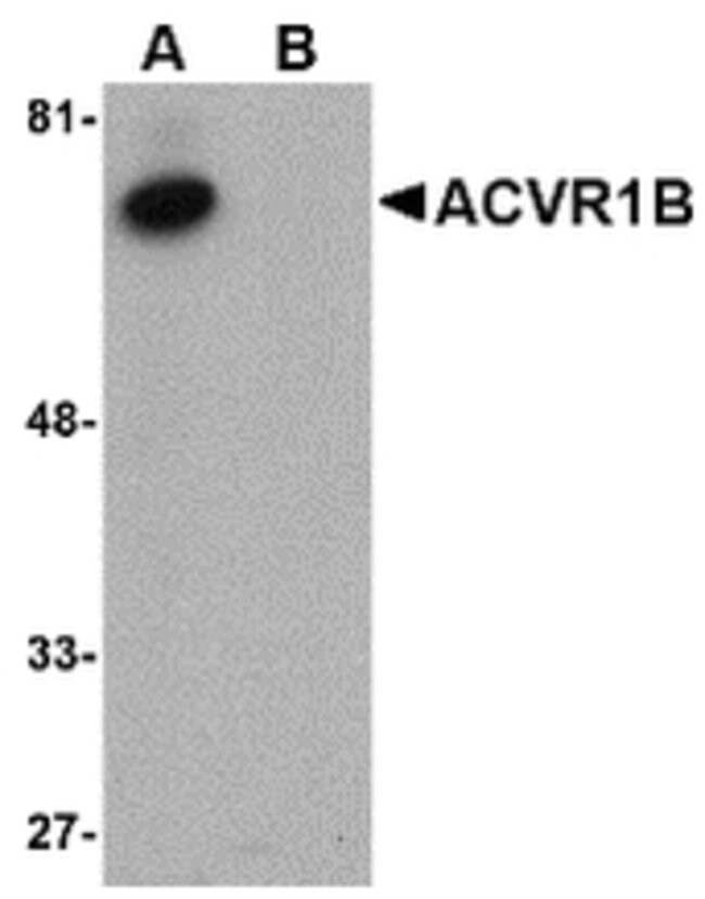 ACVR1B Polyclonal Antibody, 100  g