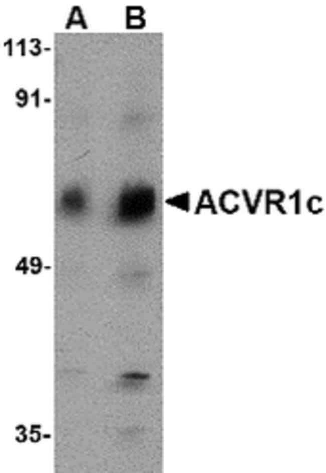 ACVR1C Polyclonal Antibody, 100  g