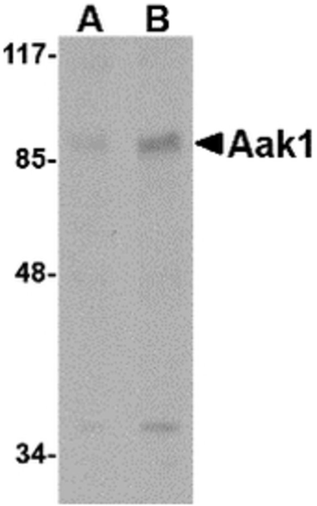 Aak1 Polyclonal Antibody, 100  g