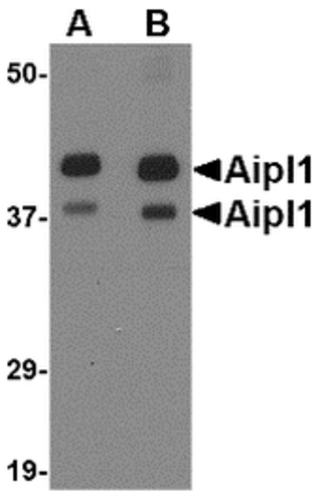 Aipl1 Polyclonal Antibody, 100  g