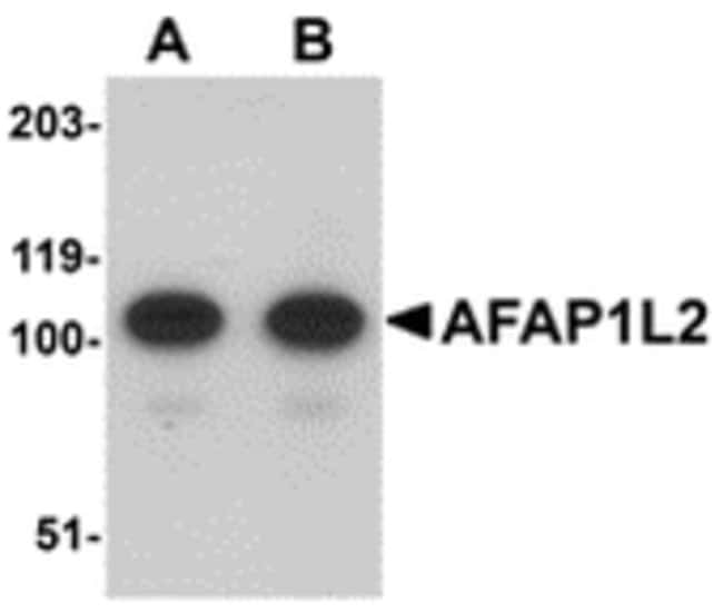 AFAP1L2 Polyclonal Antibody, 100  g