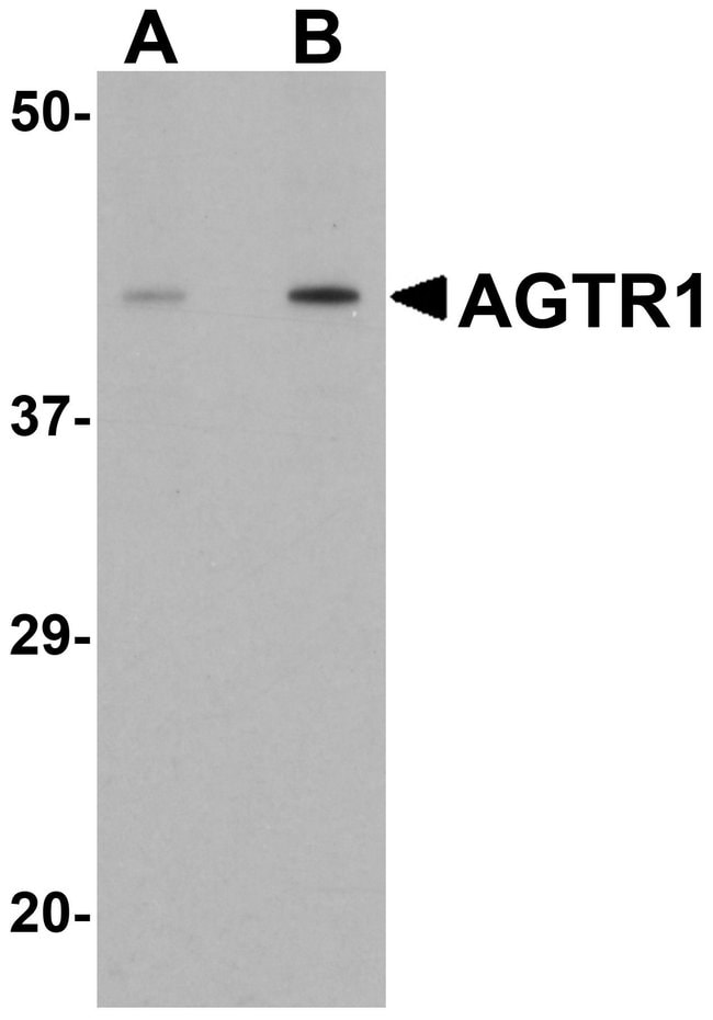 AGTR1 Polyclonal Antibody, 100  g