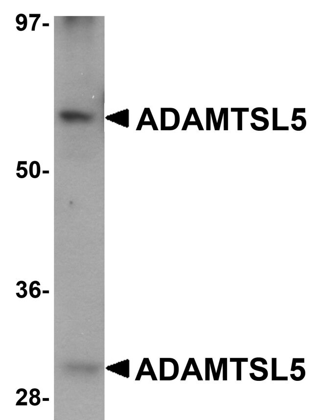 ADAMTSL5 Polyclonal Antibody, 100  g