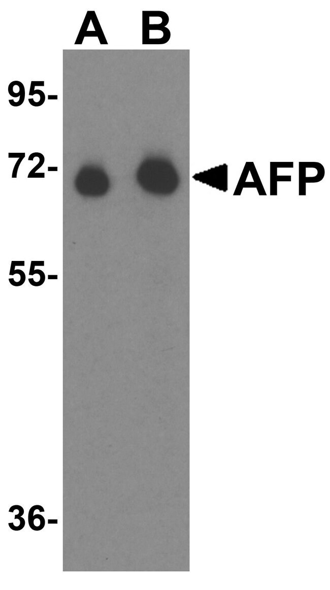 AFP Polyclonal Antibody, 100  g