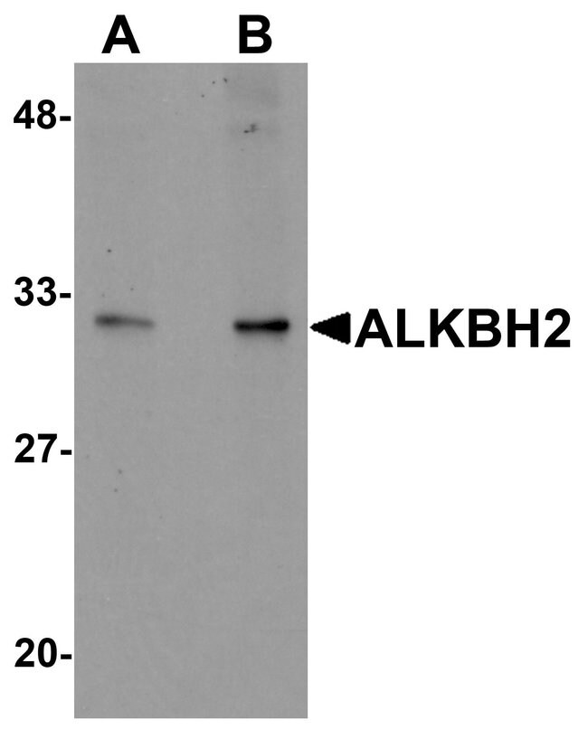 ALKBH2 Polyclonal Antibody, 100  g