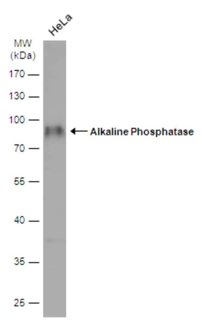 alkaline phosphatase (liver/bone/kidney)