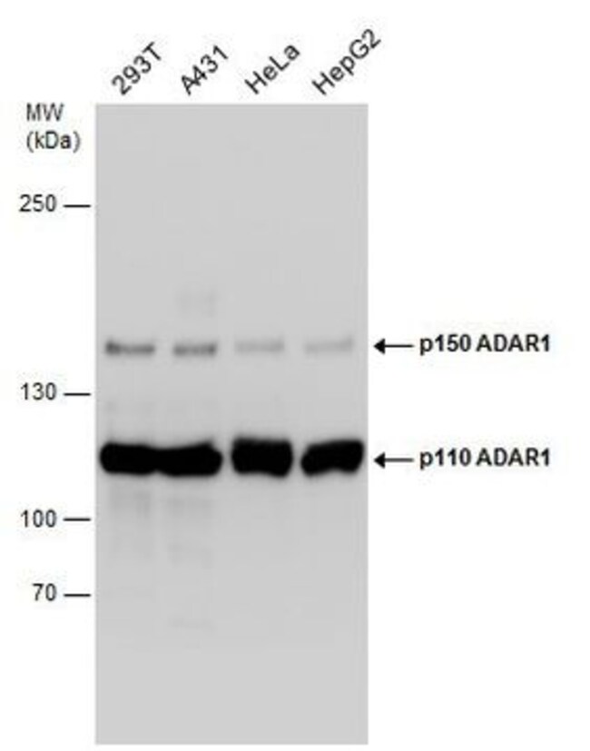 Adenosine Deaminase Polyclonal Antibody,