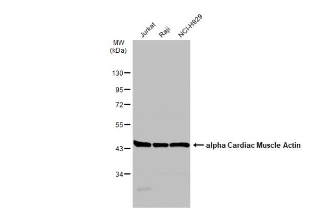 alpha sarcomeric Actin Polyclonal Antibo