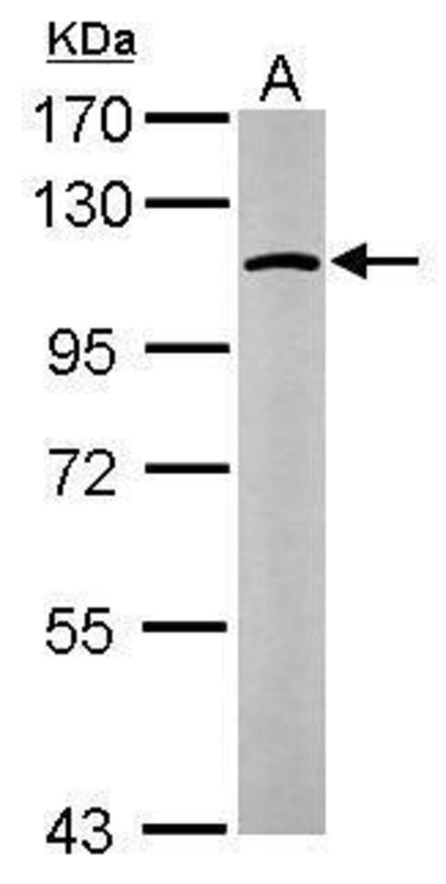 alpha Glucosidase II Polyclonal antibody