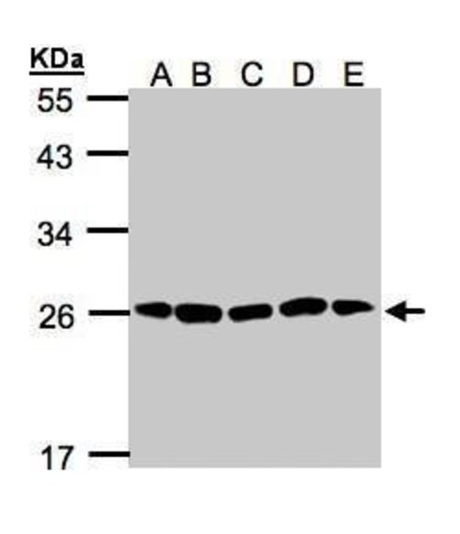 20S Proteasome alpha2 Polyclonal Antibod