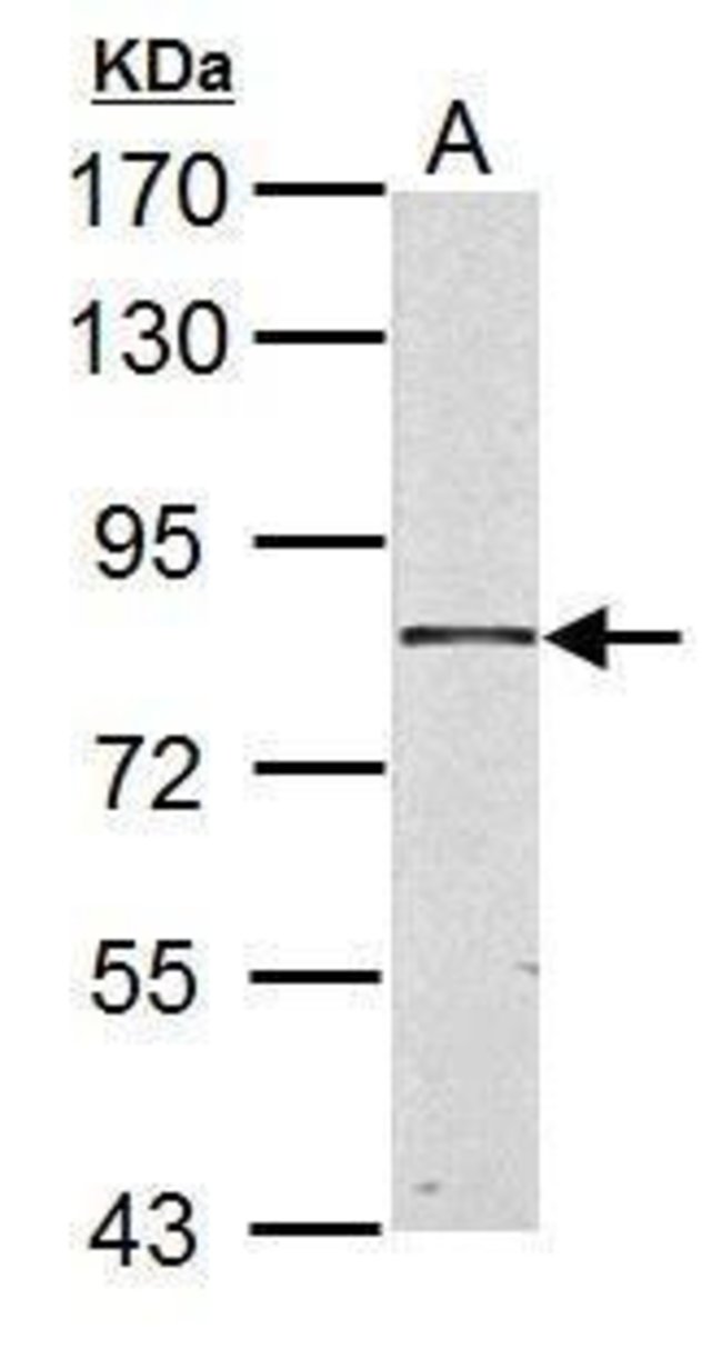 17beta-HSD4 Polyclonal Antibody, 100  g