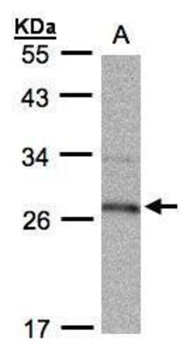 15-PGDH Polyclonal antibody, 100  g