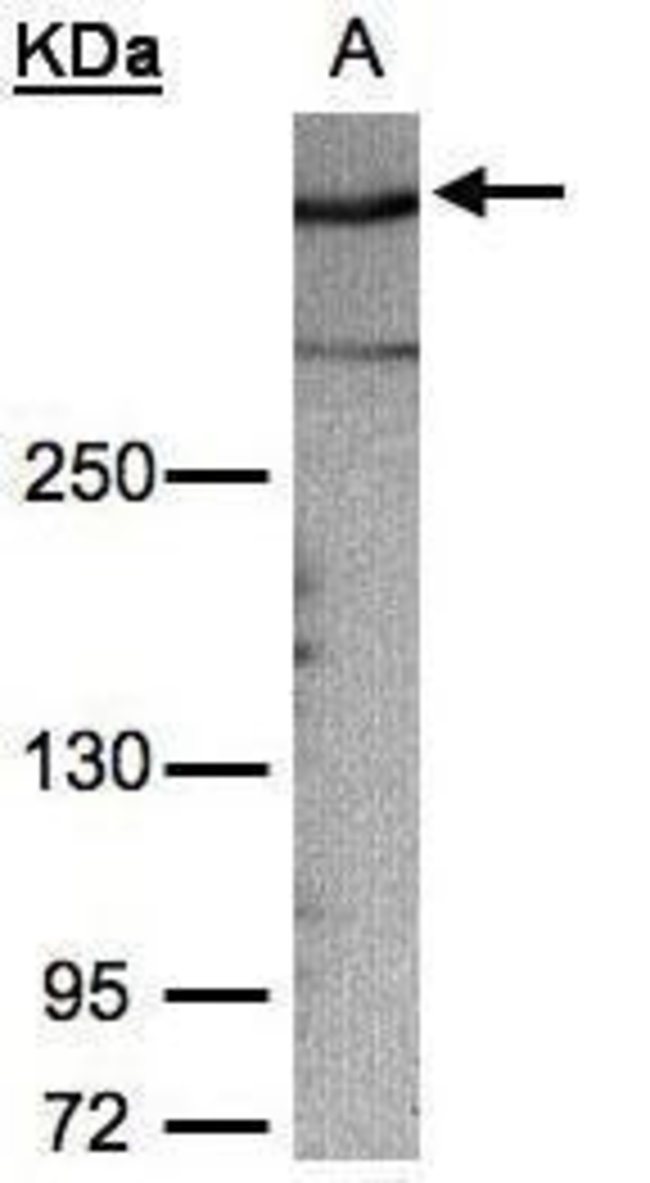 AKAP12 Polyclonal Antibody, 100  l