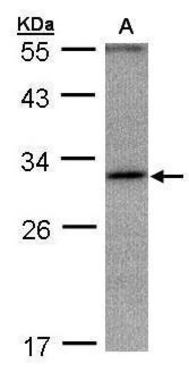 ankyrin repeat domain 45 Polyclonal Anti