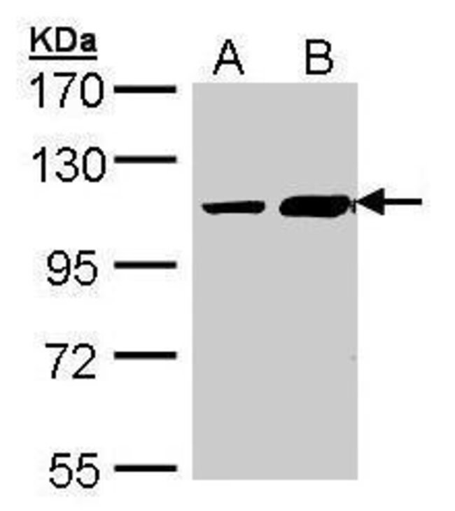 ALS2CR3 Polyclonal Antibody, 100  g