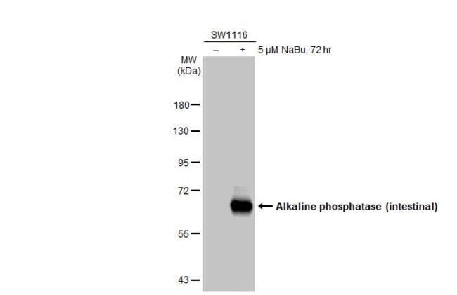 alkaline phosphatase (intestinal) Polycl