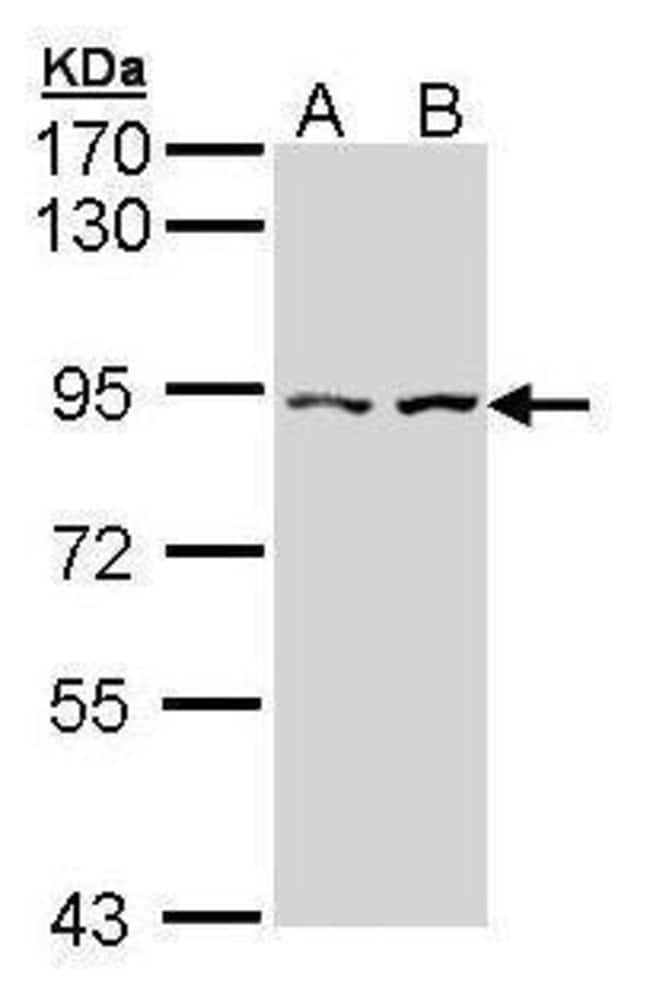 Alpha-catulin Polyclonal Antibody, 100