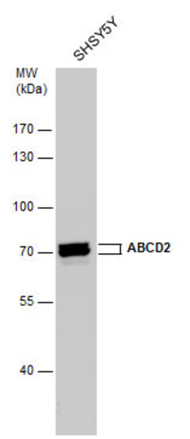 ABCD2 Polyclonal Antibody, 100  l