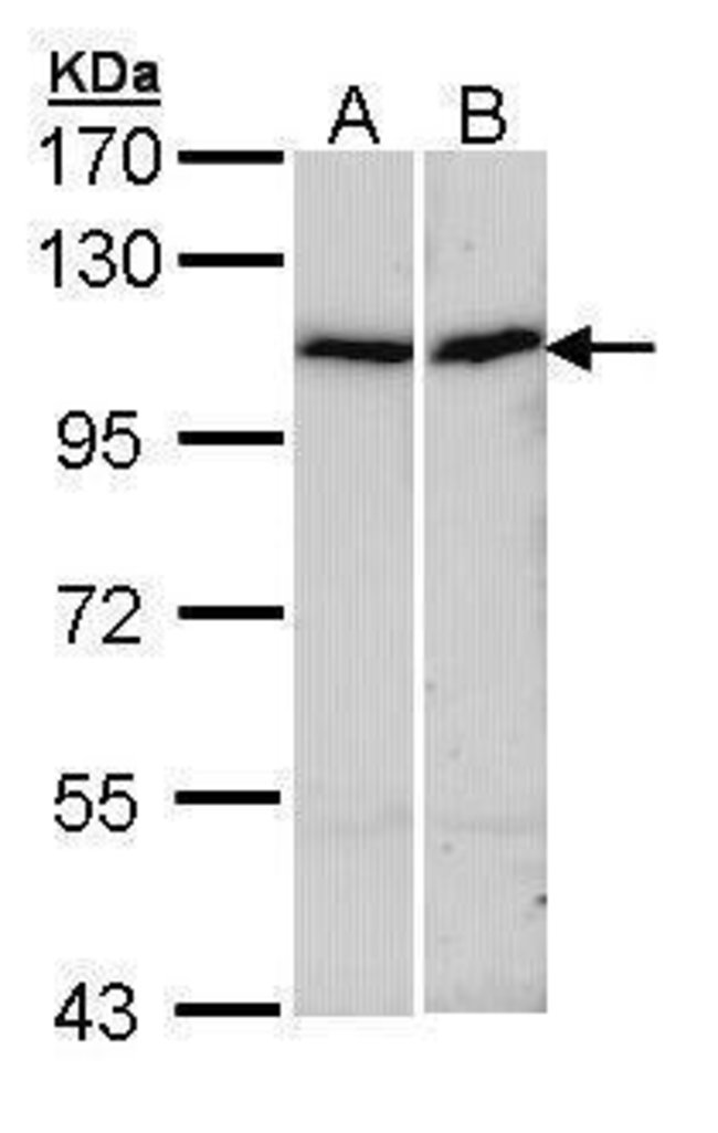 alpha Actinin 4 Polyclonal Antibody, 100