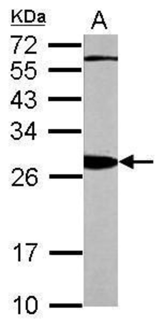 14-3-3 beta Polyclonal Antibody, 100  g