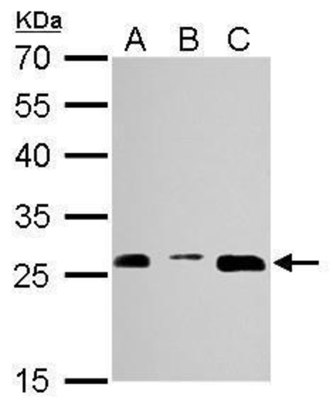 20S Proteasome alpha3 Polyclonal Antibod