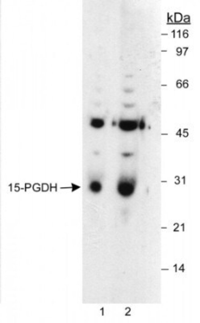 15-PGDH Polyclonal Antibody, HRP conjuga