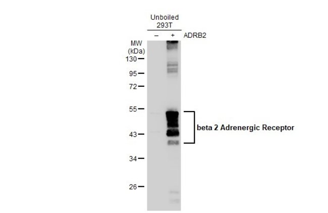 ANTI-BETA 2 ADRENERGIC RECEPTOR