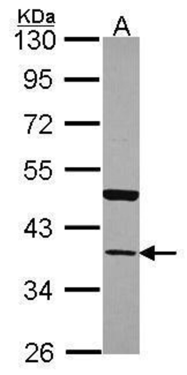 ANTI-ANNEXIN A13