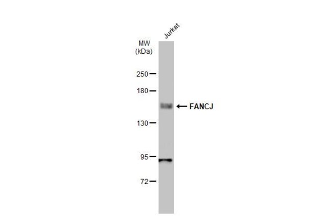 ANTI-FANCJ