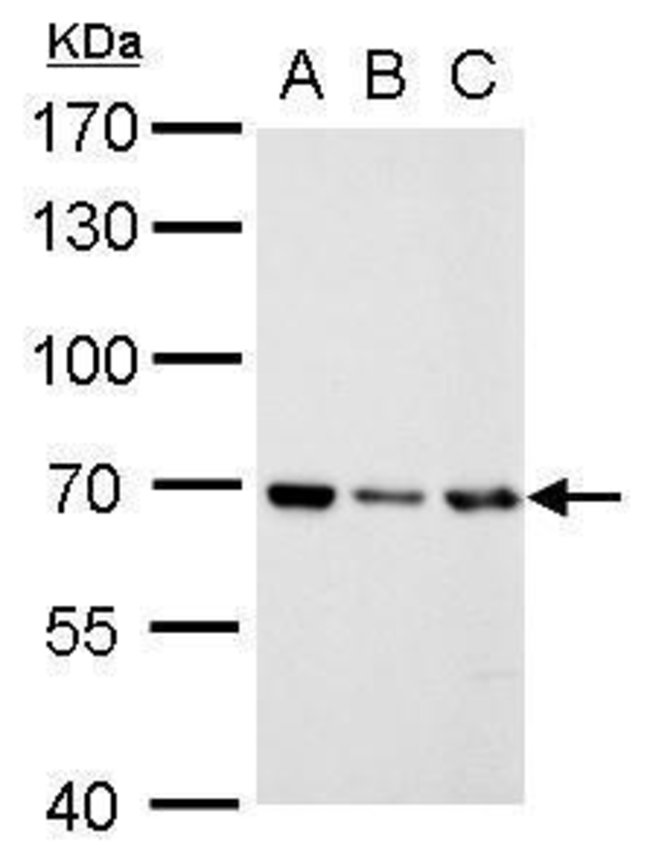 ANTI-RECQ1