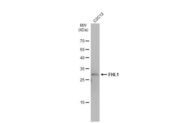 ANTI-FHL1