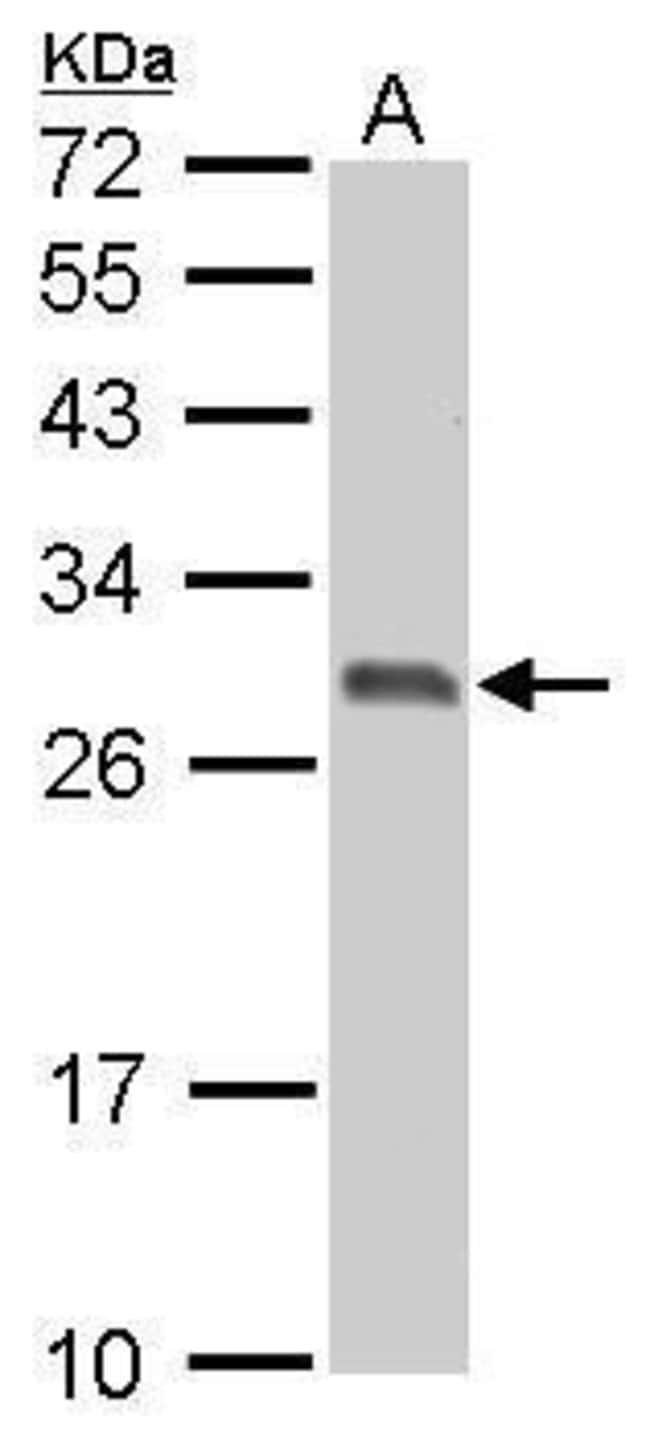 ANTI-14-3-3 SIGMA