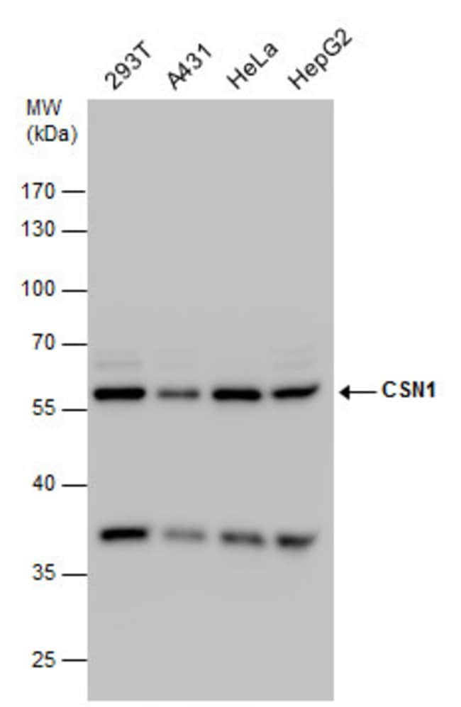 ANTI-CSN1