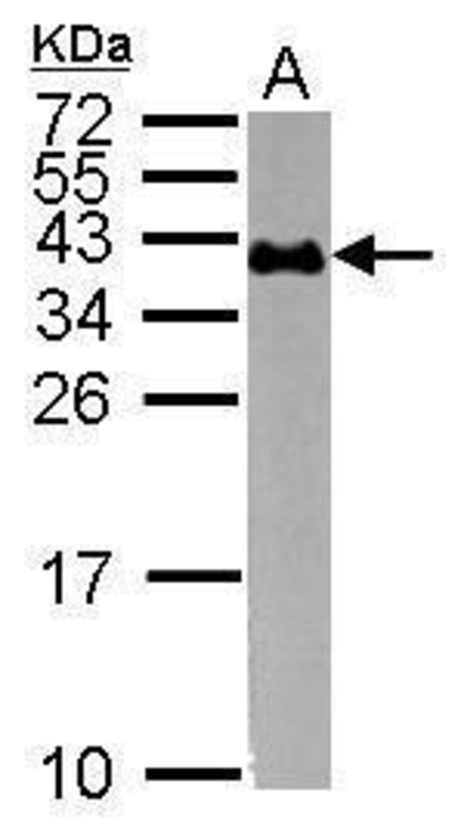 ANTI-GLYCOPHORIN A