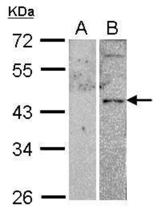 ANTI-VPAC2