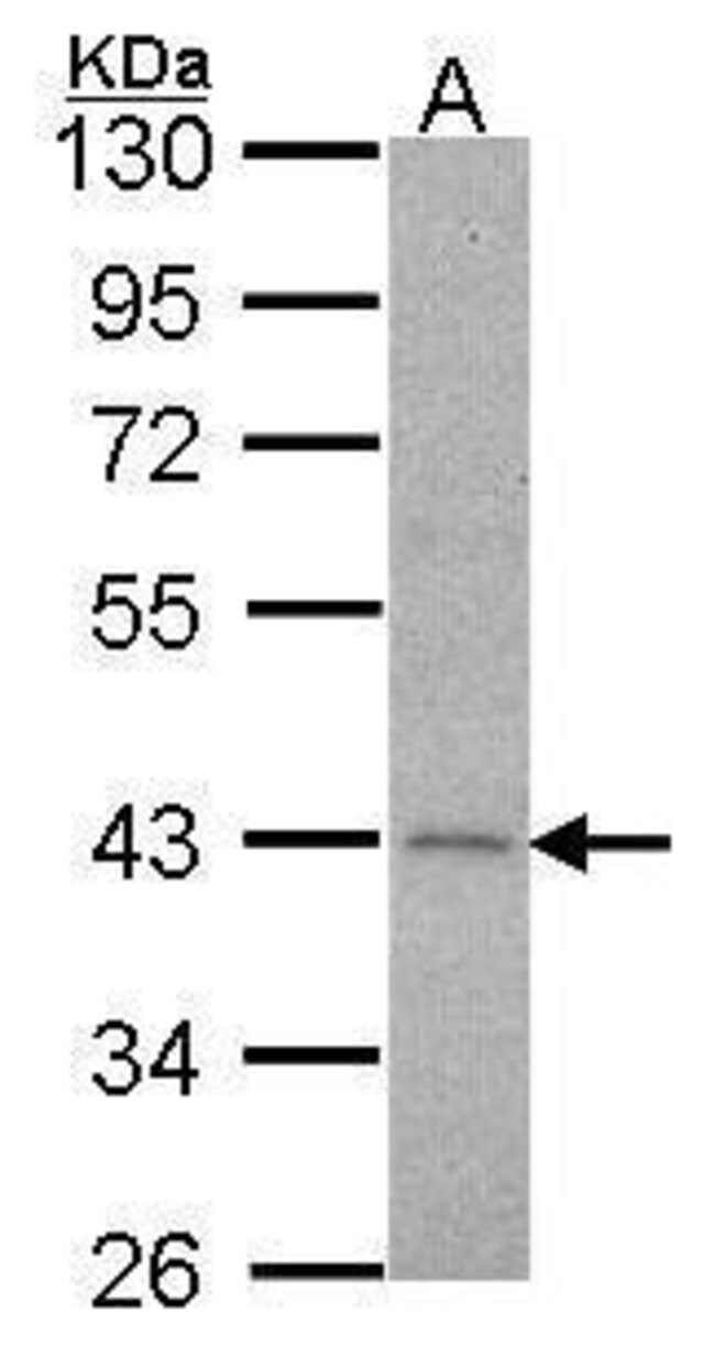 ANTI-ALPHA 2C ADRENERGIC RECEPTOR